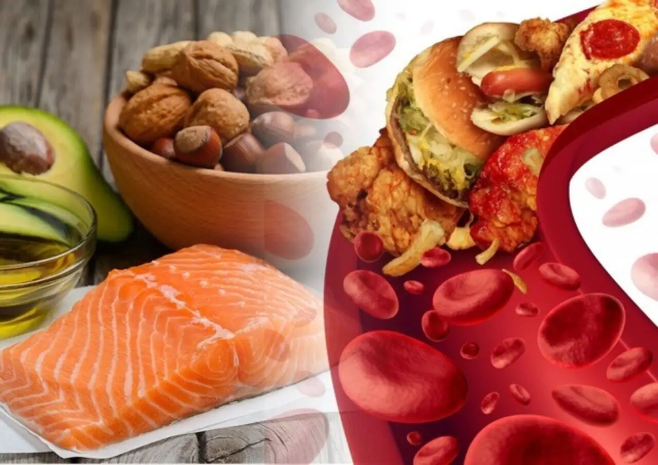 Colesterolo alto: quali cibi è meglio eliminare dalla dieta Colesterolo alto: quali cibi è meglio eliminare dalla dieta